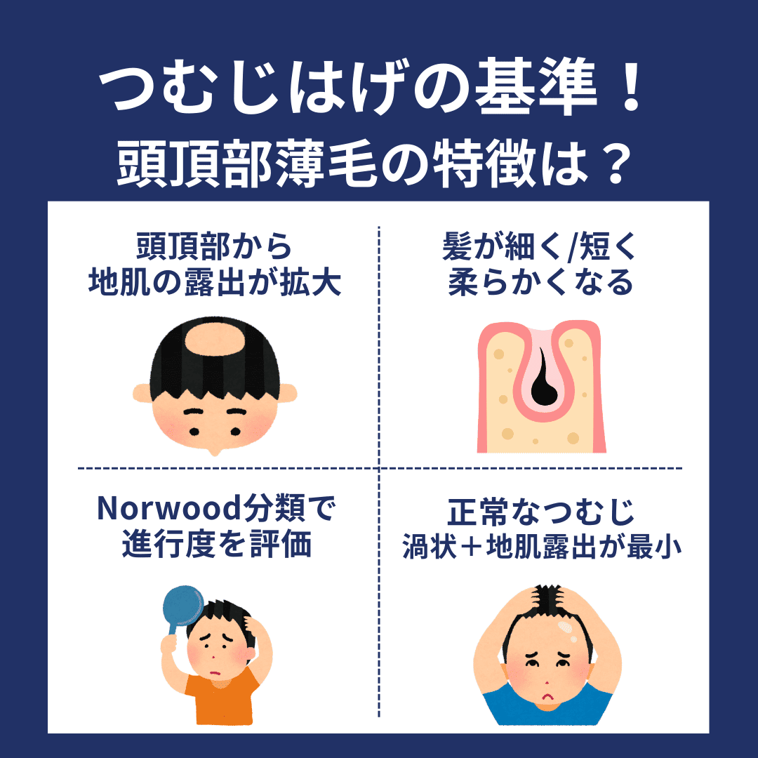つむじハゲの基準と頭頂部薄毛の特徴