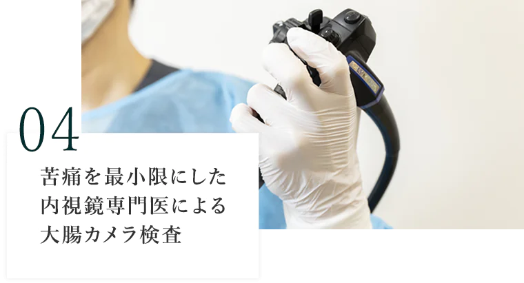 苦痛を最小限にした内視鏡専門医による大腸カメラ検査